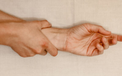 Acupuncture for Carpal Tunnel Syndrome