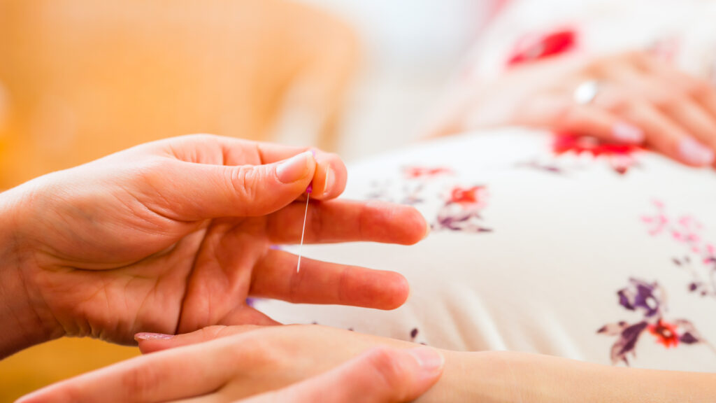 pregnant woman receiving acupuncture